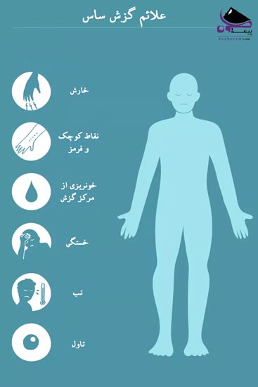 علائم گزش حشرات