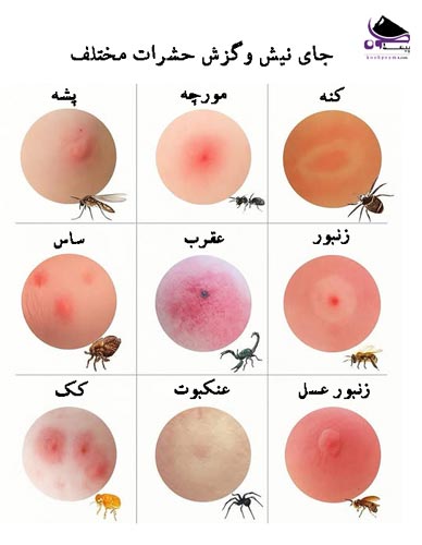 نیش حشرات مختلف